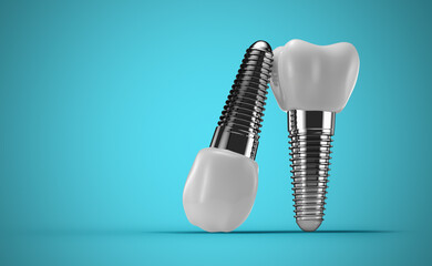 dental implants on a blue background. 3d rendering