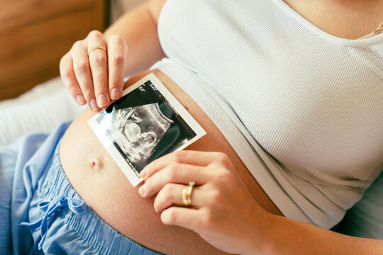 Ultrasound image pregnant baby photo. Woman holding ultrasound pregnancy picture. Pregnancy, medicine, pharmaceutics, health care and people concept.