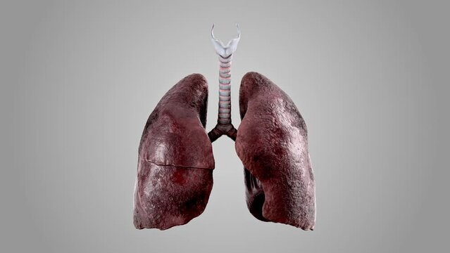 Realistic 3d animation of human lungs progress stages from healthy to sick smoker lungs. High quality 4k footage