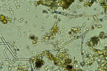 Fungal and fungi hyphae under the microscope in the soil and compost, in a soil biology and...