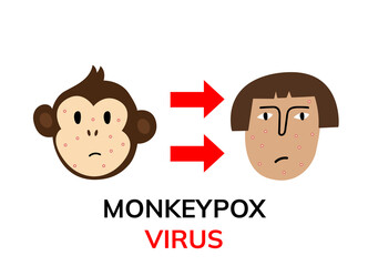 Monkeypox virus illustration. Sad woman with skin rash and monkey with skin rash. Flat illustration. Medical illustration concept.