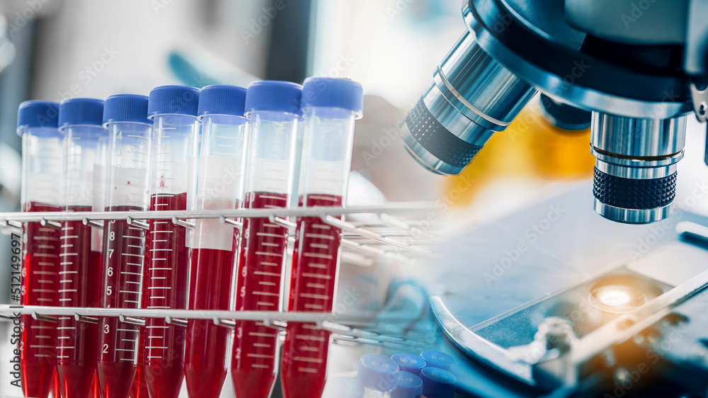 Wall mural lab technician assistant analyzing a blood sample in test tube at laboratory with microscope. medica