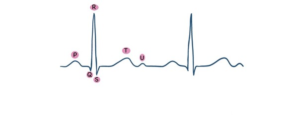 ECG image show normal sinus rhythm, vector illustration