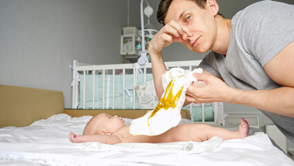 Young father changes daughter dirty diaper and tries to hold breath pinching nose from unpleasant odor. Process of changing diaper for little baby, closeup - obrazy, fototapety, plakaty