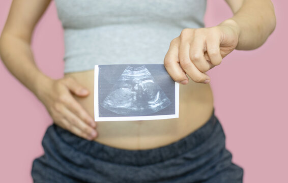 pregnant woman is holding ultrasound picture in one hand and on the belly another hand. pregnancy and health concept. new life, new baby birth. fetus in tummy, unborn yet baby. motherhood.