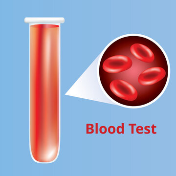 Blood test with medical tube with red blood cells , vector illustration