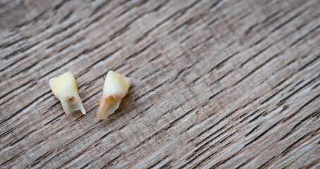 Fototapeta na wymiar Milk tooth , Close up baby teeth of tooth loss on wooden , milk tooth dental health problems concept