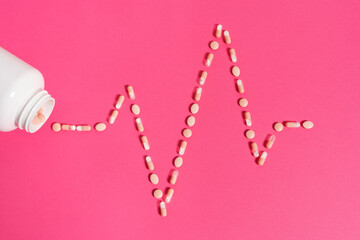 an EKG pattern