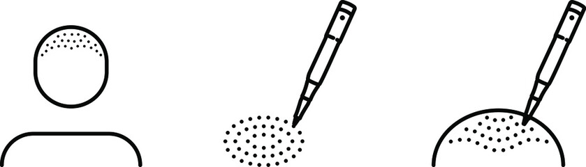 Trichopigmentation of the bald head icon , vector