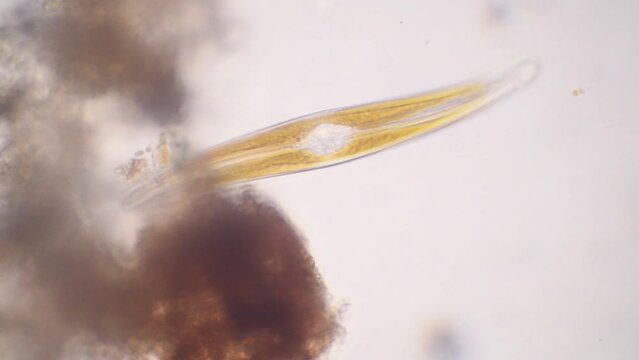 freshwater diatom, magnification x400, algae,  freshwater diatoms,