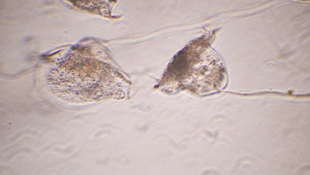 Vorticella, cilia,  freshwater, protozoa,  magnification x1000,   