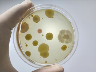 Microbial culture result confirmation photo