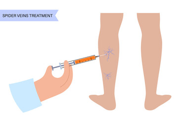 Varicose Injection procedure