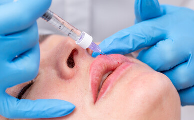 Lip augmentation. Beautician injects hyaluronic acid into the lips of a girl with a syringe. The cosmetologist doctor performs the procedure in the cosmetology office. Plastic surgery.