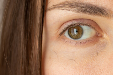 Young woman with eyelash loss problem. Macro