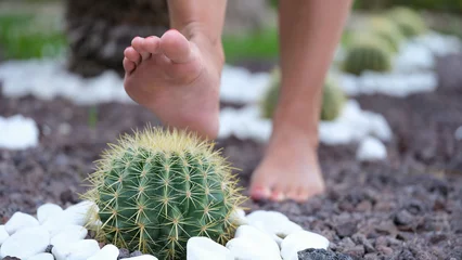 Foto op Canvas Woman stepping on round cactus with sharp thorns closeup © H_Ko