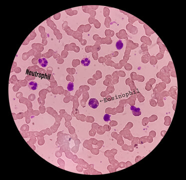 Red Blood Cells Background