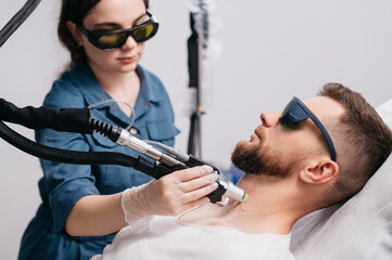 Laser depilation of beard contour. The depilation master treats the neck of a man with a laser. Close up.