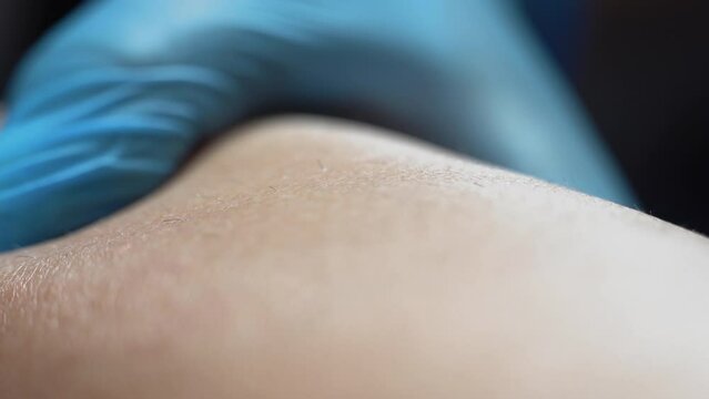 process of permanent unwanted hair removal, using an electroepilation device and tweezers.