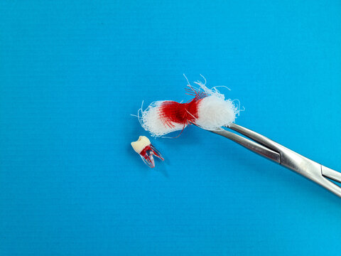 Dental tools for tooth extraction on table