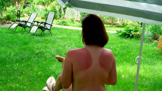 Close up of a woman's back with uneven pigmentation. woman applying sunscreen to back at the lawn near the house. High quality 4k footage