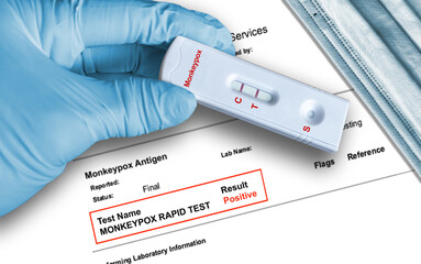 Positive Monkeypox rapid test result by using rapid testing cassette to detect virus antigen on skin lesions