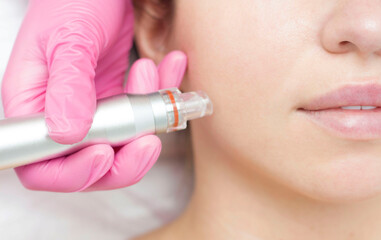 Needle mesotherapy. Cosmetologist performs needle mesotherapy on a womans face. Beautiful woman...