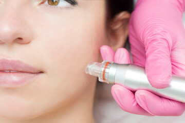 Needle mesotherapy. Cosmetologist performs needle mesotherapy on a womans face. Beautiful woman...