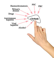 Eight major causes of Cirrhosis