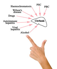 Eight major causes of Cirrhosis