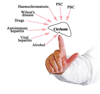 Eight major causes of Cirrhosis