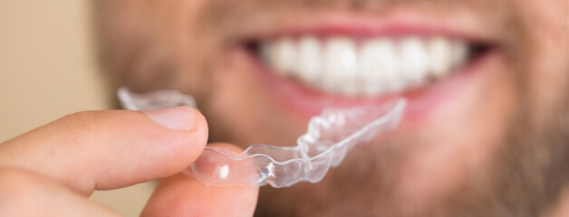 Man Holding Transparent Aligner