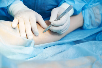 Leg of the patient undergoing surgical operation