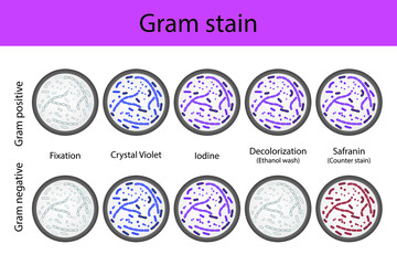 Diagram showing gram staining microbiology lab technique steps - microbiology laboratory using Crystal violet and Safranin - obrazy, fototapety, plakaty