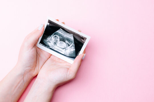 Ultrasound image pregnant baby photo. Woman hands holding ultrasound pregnancy picture on pink background. Pregnancy, medicine, pharmaceutics, health care and people concept.