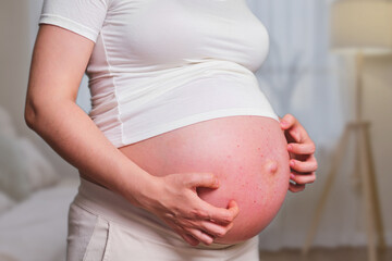 Pimples on the belly of a pregnant woman,, home living room
