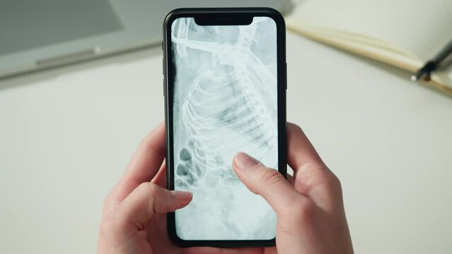 Doctor veterinarian examining hedgehog skeleton roentgen close-up. Woman vet analyzing animal bones x-ray on smartphone. Healthcare and medicine concept.