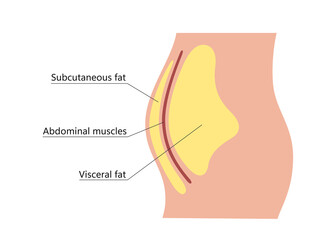 Visceral and subcutaneous fat around waistline. Location of visceral fat in abdominal cavity. Types of human obesity. Medical scheme. Vector illustration isolated on white background.