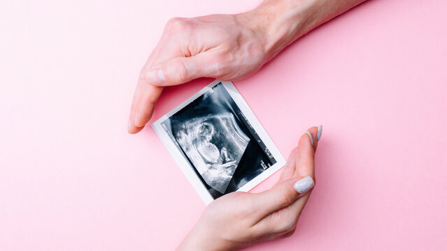 Ultrasound picture pregnant baby photo. Woman hands holding ultrasound pregnancy image on pink background. Concept of pregnancy, maternity, expectation for baby birth.