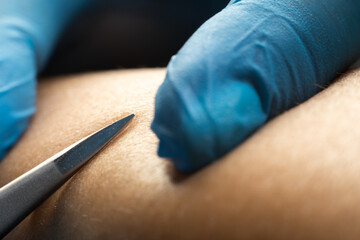 close-up detail of woman using pair of tweezers, removing hair from leg in a beauty salon.