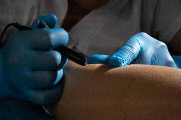 process of permanent unwanted hair removal, using an electroepilation device, electrolysis in a beauty salon