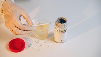 Laboratory in hospital. Doctor does test. Health worker opens container with biological material and wets test strip with litmus paper and waits for result. Glucose in urine. Ketone bodies are absent