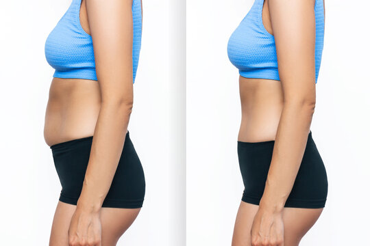 Two shots of a woman in profile with a belly with excess fat and toned slim stomach with abs before and after losing weight isolated on a white background. Result of a diet, liposuction, training