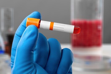Blood sample of patient for test in laboratory. doctor with Blood tube for Sodium test in lab