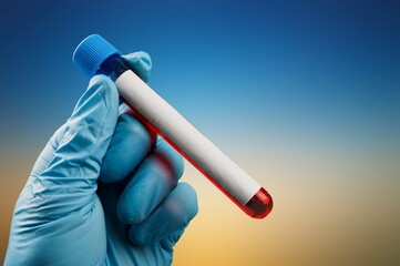 Fototapeta premium Iron Test Medical check up test tube with biological sample concept