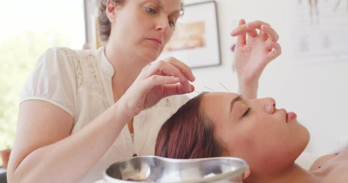 Professional therapists place acupuncture needles in a clients face releasing facial muscle tension with an alternative relaxing treatment. An acupuncturist treating a female patient in the clinic