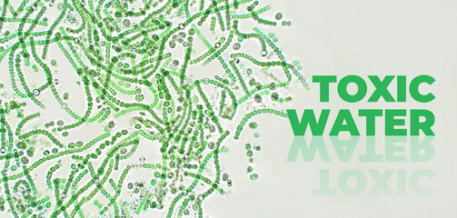 Nostoc sp. blue green algae under microscopic view with Toxic Water text, Cyanobacteria. Global pollution of the environment and water bodies. Water blooming, flowering in summer