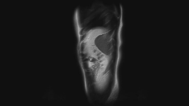 Voluminous CT scan of the abdomen. Computed tomography of the gastrointestinal tract, liver and kidneys
