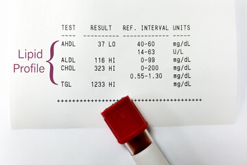 Blood sample isolated for Lipid Profile test with abnormal report.
