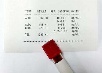 Blood sample isolated for Lipid Profile test with abnormal report.